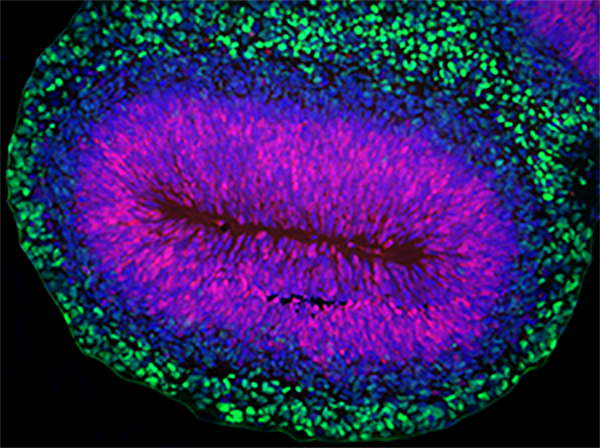 Human Organoid 1